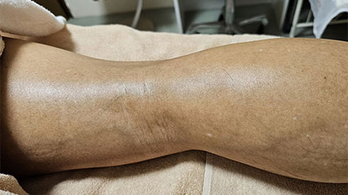 ビフォーアフター