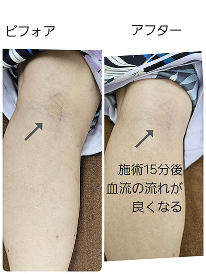 ビフォーアフター