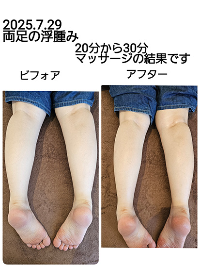 ビフォーアフター