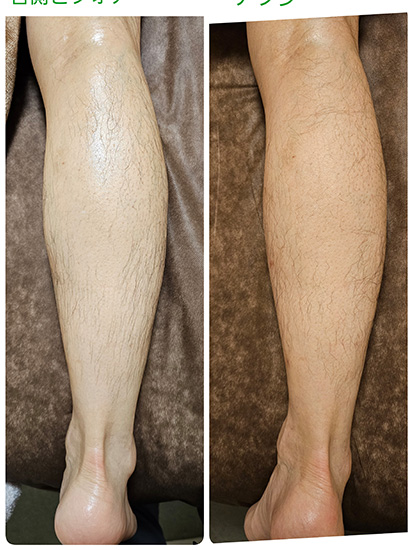 ビフォーアフター