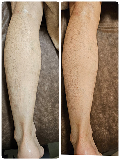 ビフォーアフター