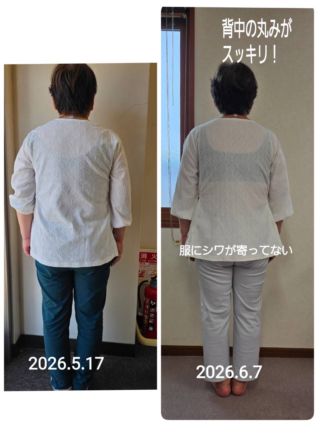 ビフォーアフター