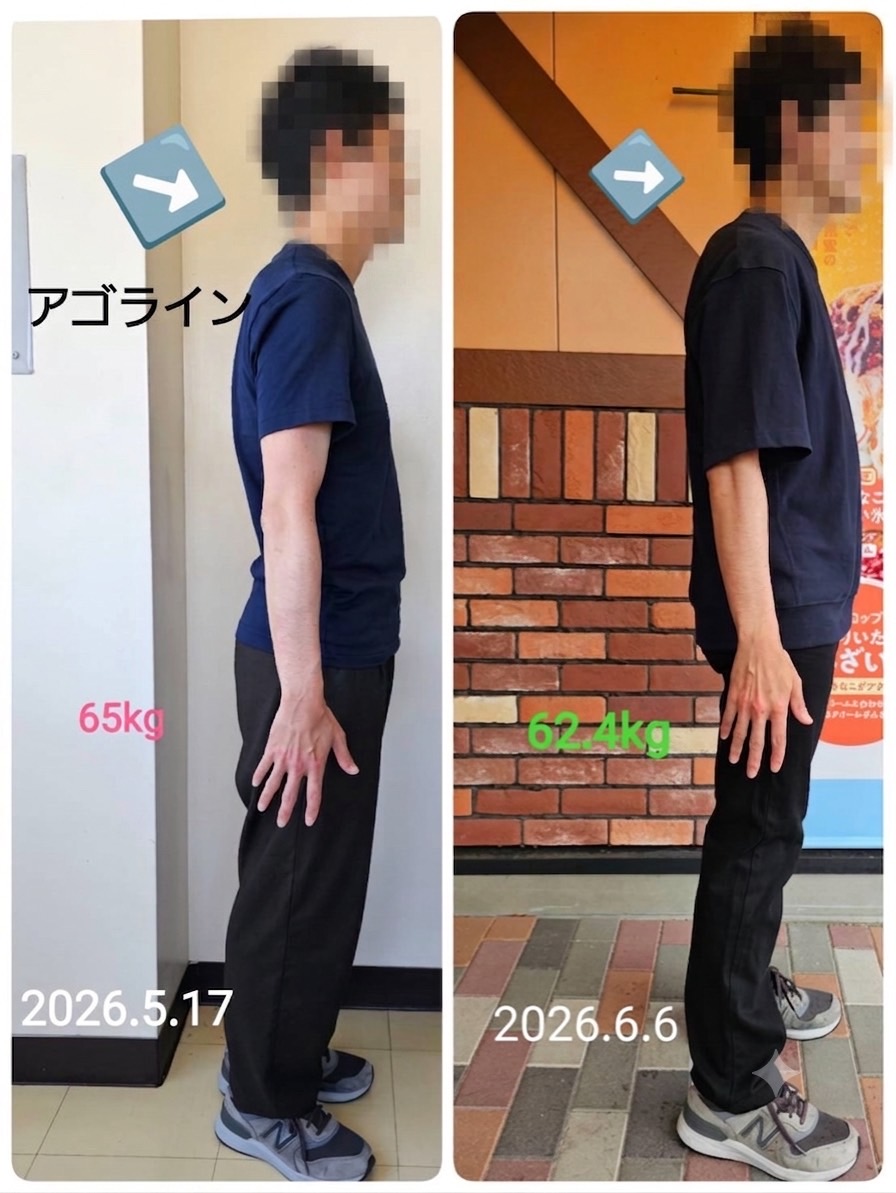 ビフォーアフター